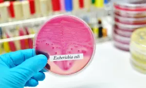 Ręka w niebieskiej rękawiczce trzyma szalkę Petriego z różową pożywką, na której widoczne są kolonie bakterii Escherichia coli.