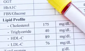 Wynik lipidogramu: cholesterol 175 mg/dL, HDL 89 mg/dL, LDL 76 mg/dL. Sprawdź, czy cholesterol nie HDL mieści się w normie.