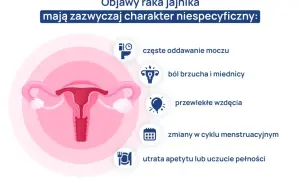 Objawy raka jajnika: częste oddawanie moczu, ból brzucha, wzdęcia, zmiany cyklu, utrata apetytu.