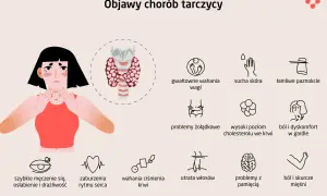 Ilustracja przedstawia objawy chorób tarczycy, w tym choroby Hashimoto: zmęczenie, problemy z wagą, skórą, włosami, pamięcią i bóle mięśni.