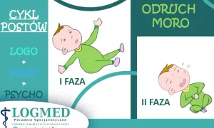 Ilustracja pokazuje dwie fazy odruchu Moro u niemowląt: I faza - dziecko wyciąga ręce i nogi, II faza - dziecko przyciąga kończyny do ciała.