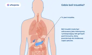 Ilustracja pokazuje ludzkie ciało z zaznaczoną trzustką. Ból trzustki odczuwany jest w górnej części brzucha.