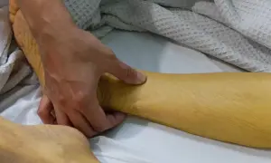 Dłoń bada zażółconą skórę nogi, która może wskazywać na wzw a.