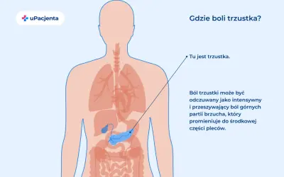 Ilustracja pokazuje ludzkie ciało z zaznaczoną trzustką. Ból trzustki odczuwany jest w górnej części brzucha.