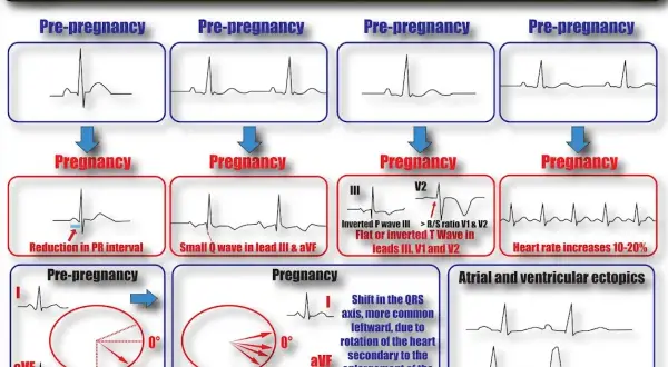 EKG w ciąży: kiedy jest konieczne i co musisz wiedzieć?