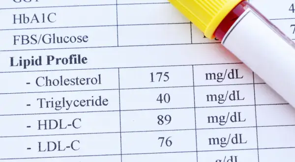 Wynik lipidogramu: cholesterol 175 mg/dL, HDL 89 mg/dL, LDL 76 mg/dL. Sprawdź, czy cholesterol nie HDL mieści się w normie.