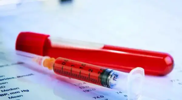 Co oznacza WBC w badaniu krwi: Kluczowe informacje o leukocytach