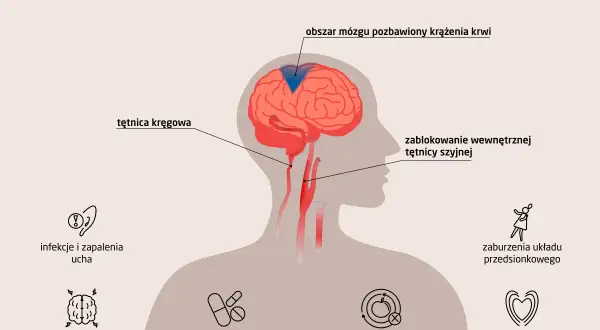 Ilustracja pokazuje przyczyny zawrotów głowy: problemy z krążeniem mózgu, infekcje ucha, choroby mózgu, leki, zaburzenia metaboliczne, sercowo-naczyniowe i układu przedsionkowego.