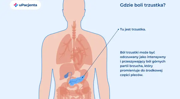Ilustracja pokazuje ludzkie ciało z zaznaczoną trzustką. Ból trzustki odczuwany jest w górnej części brzucha.