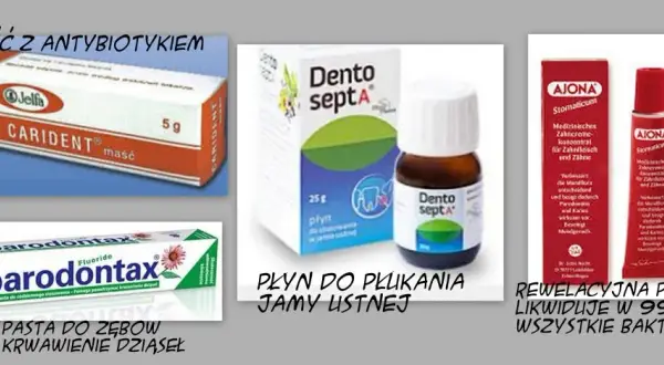 Jakie leki na zapalenie dziąseł? Skuteczne metody leczenia