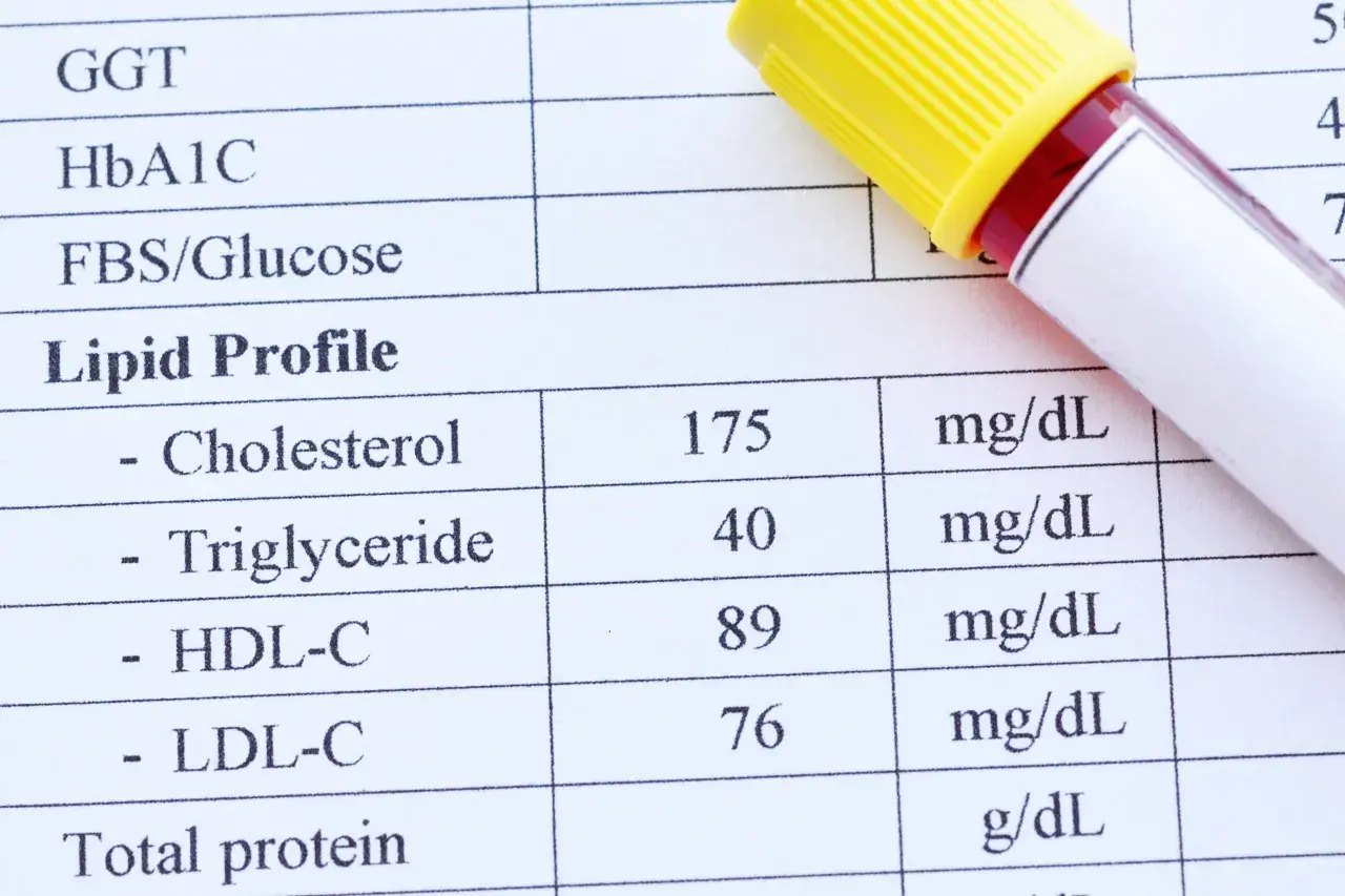 Wynik lipidogramu: cholesterol 175 mg/dL, HDL 89 mg/dL, LDL 76 mg/dL. Sprawdź, czy cholesterol nie HDL mieści się w normie.
