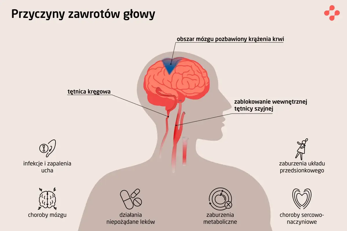 Ilustracja pokazuje przyczyny zawrotów głowy: problemy z krążeniem mózgu, infekcje ucha, choroby mózgu, leki, zaburzenia metaboliczne, sercowo-naczyniowe i układu przedsionkowego.