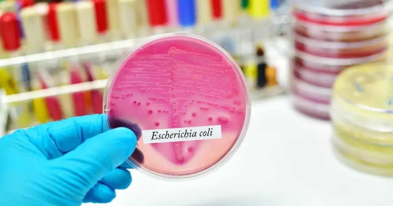 Ręka w niebieskiej rękawiczce trzyma szalkę Petriego z różową pożywką, na której widoczne są kolonie bakterii Escherichia coli.