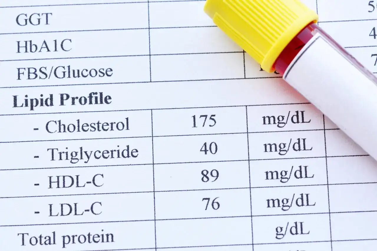 Wynik lipidogramu: cholesterol 175 mg/dL, HDL 89 mg/dL, LDL 76 mg/dL. Sprawdź, czy cholesterol nie HDL mieści się w normie.