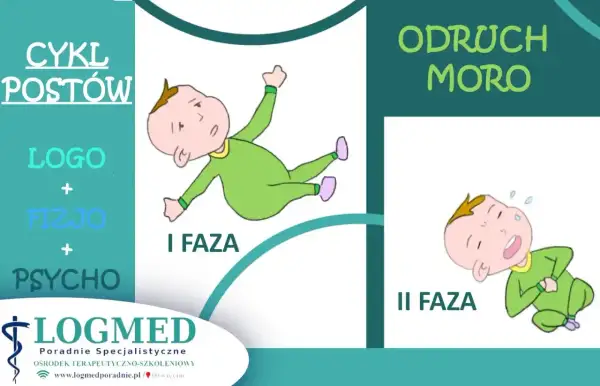 Ilustracja pokazuje dwie fazy odruchu Moro u niemowląt: I faza - dziecko wyciąga ręce i nogi, II faza - dziecko przyciąga kończyny do ciała.