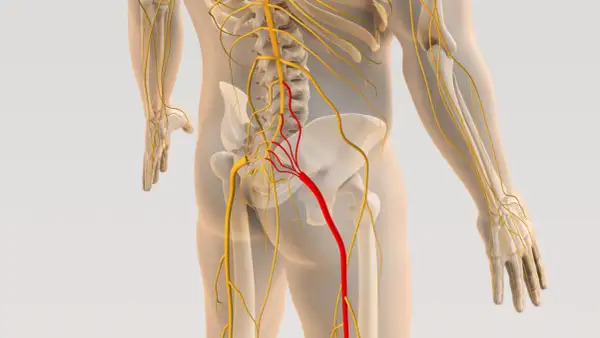 Anatomia układu nerwowego, z zaznaczonym na czerwono nerwem, który może być objęty dyskopatią lędźwiową.